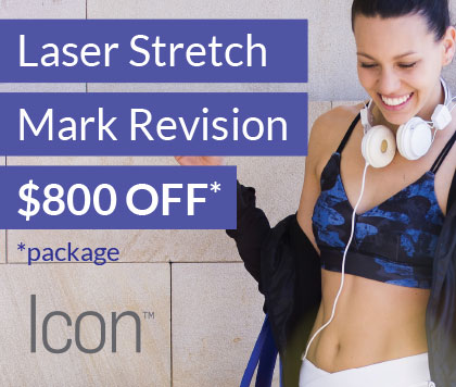 Laser Stretch Mark Revision Special