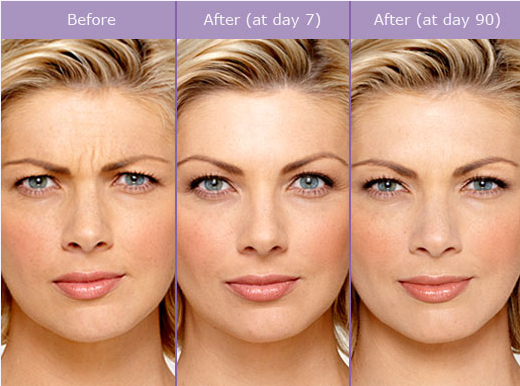 anti aging facial fairfax va Cele mai bune recenzii despre produse anti-îmbătrânire pentru piele